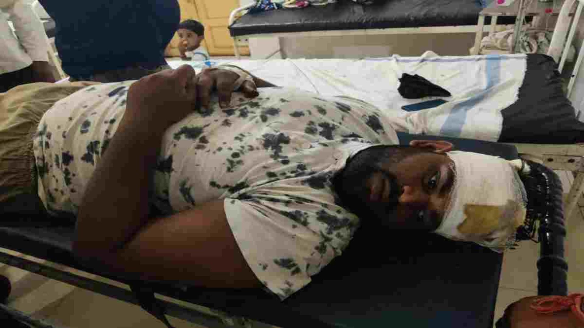 Satna News: रास्ते के विवाद ने लिया हिंसक मोड़, घायल पक्ष ने निष्पक्ष जांच और कार्रवाई की मांग की