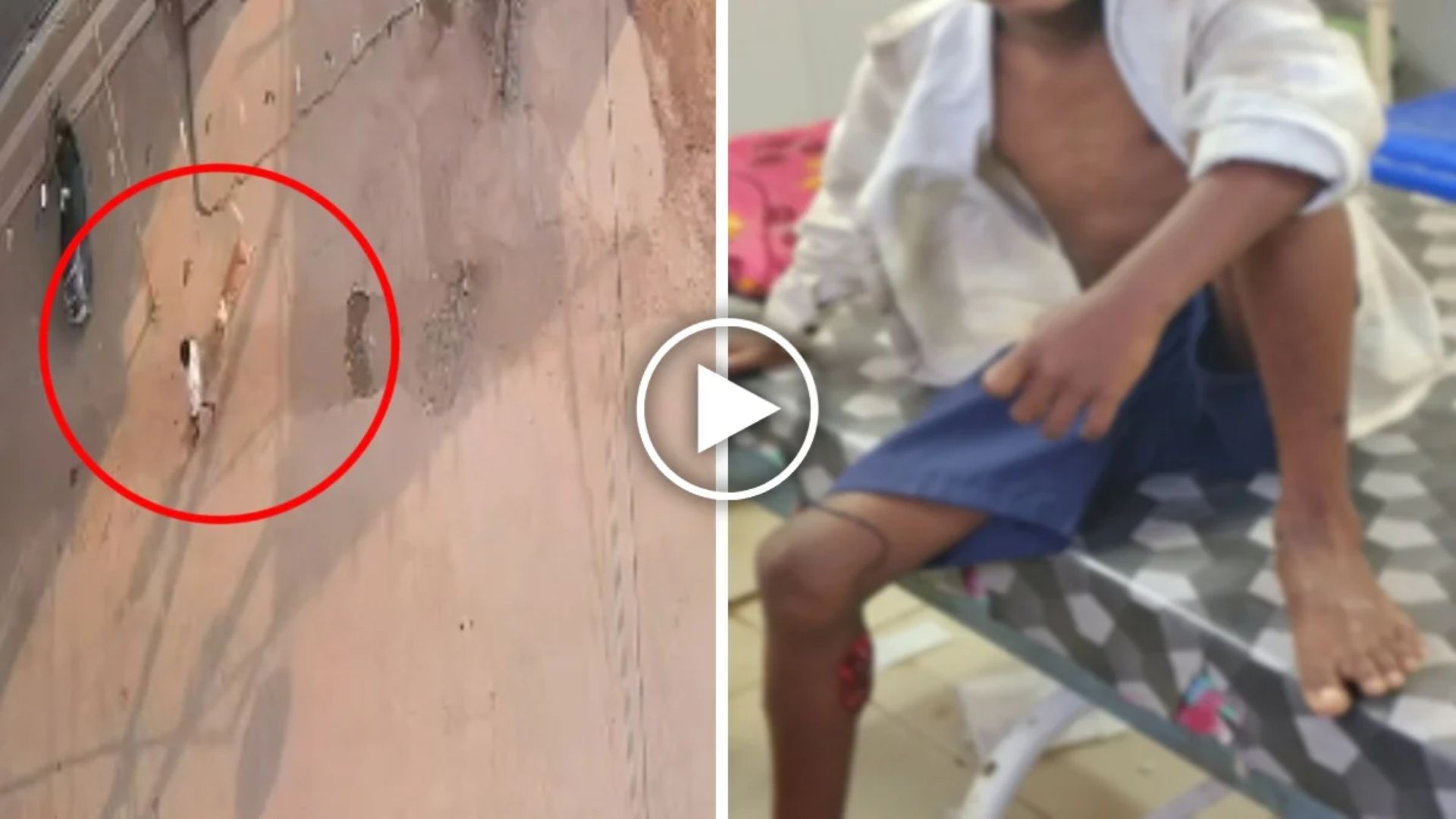 Sarangarh-Bilaigarh News: चार वार्डों में आवारा कुत्ते का आतंक, 31 लोगों को काटा, हमले का वीडियो आया सामने